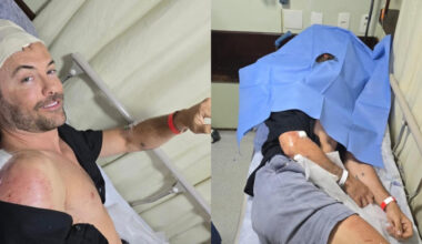 Kayky Brito atualiza estado de saúde após sofrer novo acidente