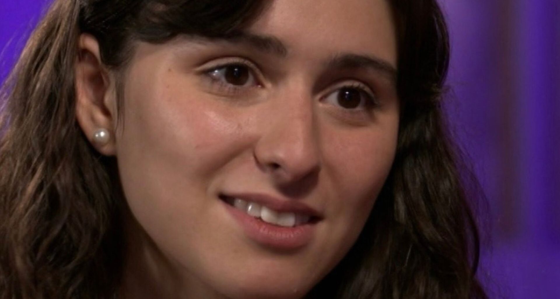 "Havia partes em que eu não tinha cabelo nenhum"