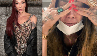 Maya Massafera chora e revela complicações após retirar ossos do maxilar