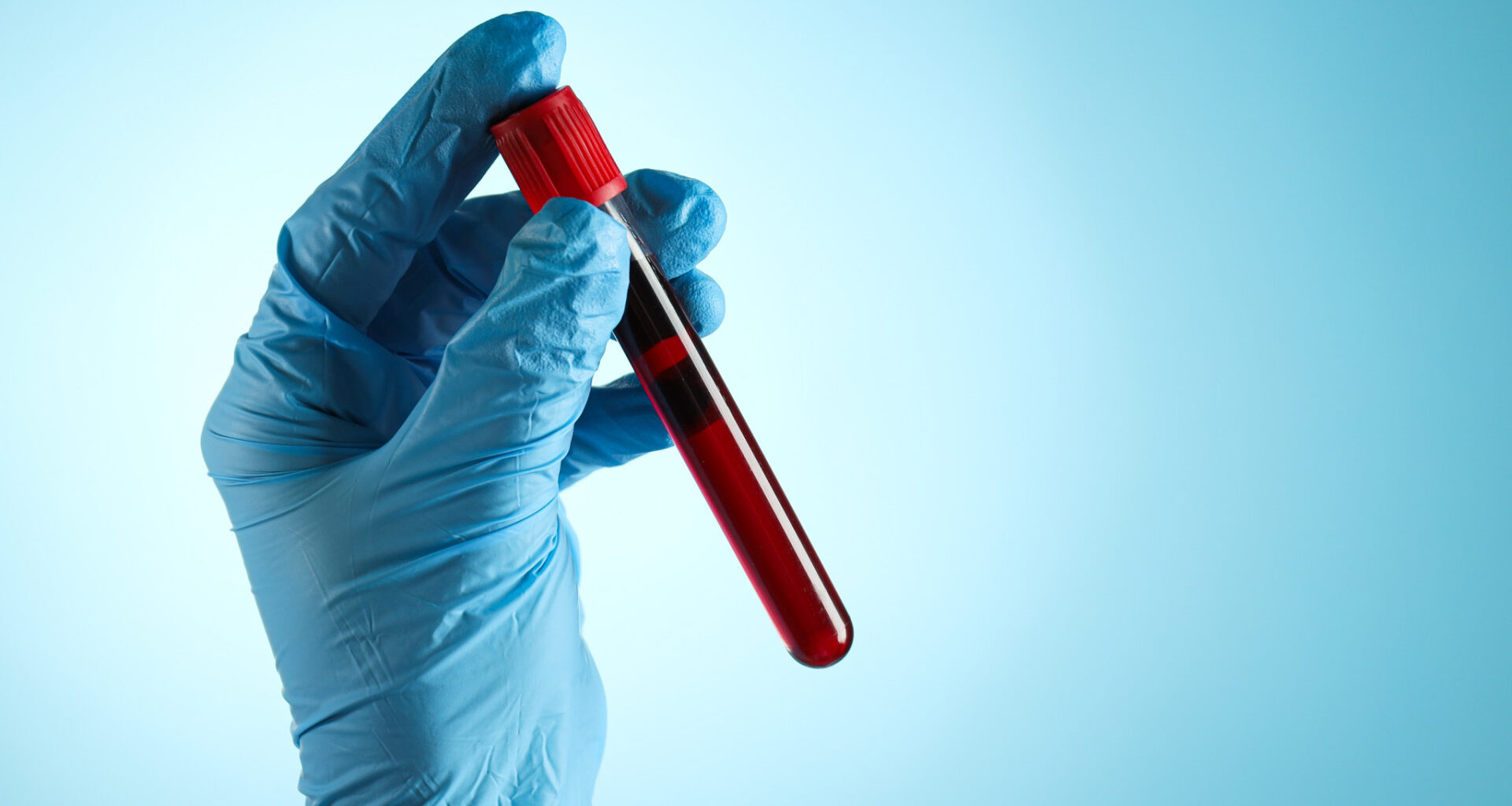 Teste de sangue pode detetar várias doenças 10 anos antes dos sintomas