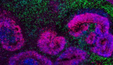 Cientistas traçam mapa inédito do desenvolvimento do cérebro humano