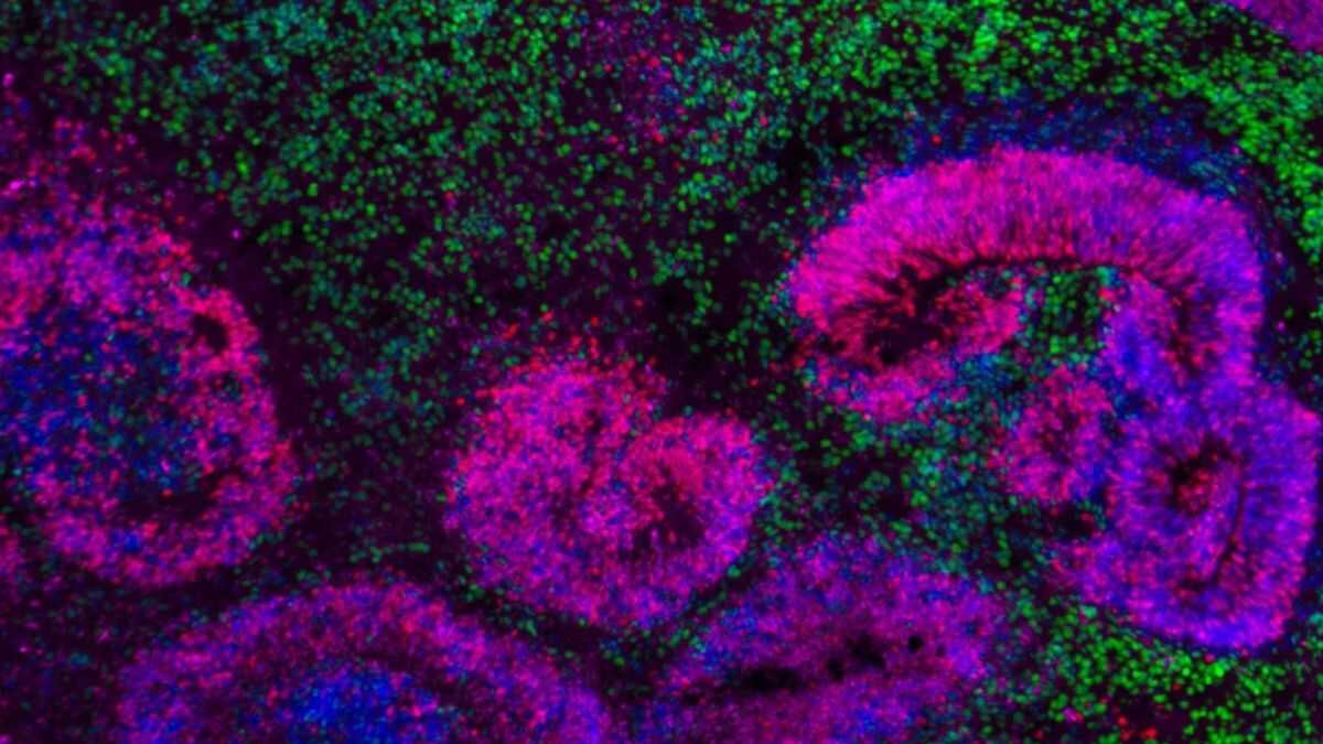 Cientistas traçam mapa inédito do desenvolvimento do cérebro humano
