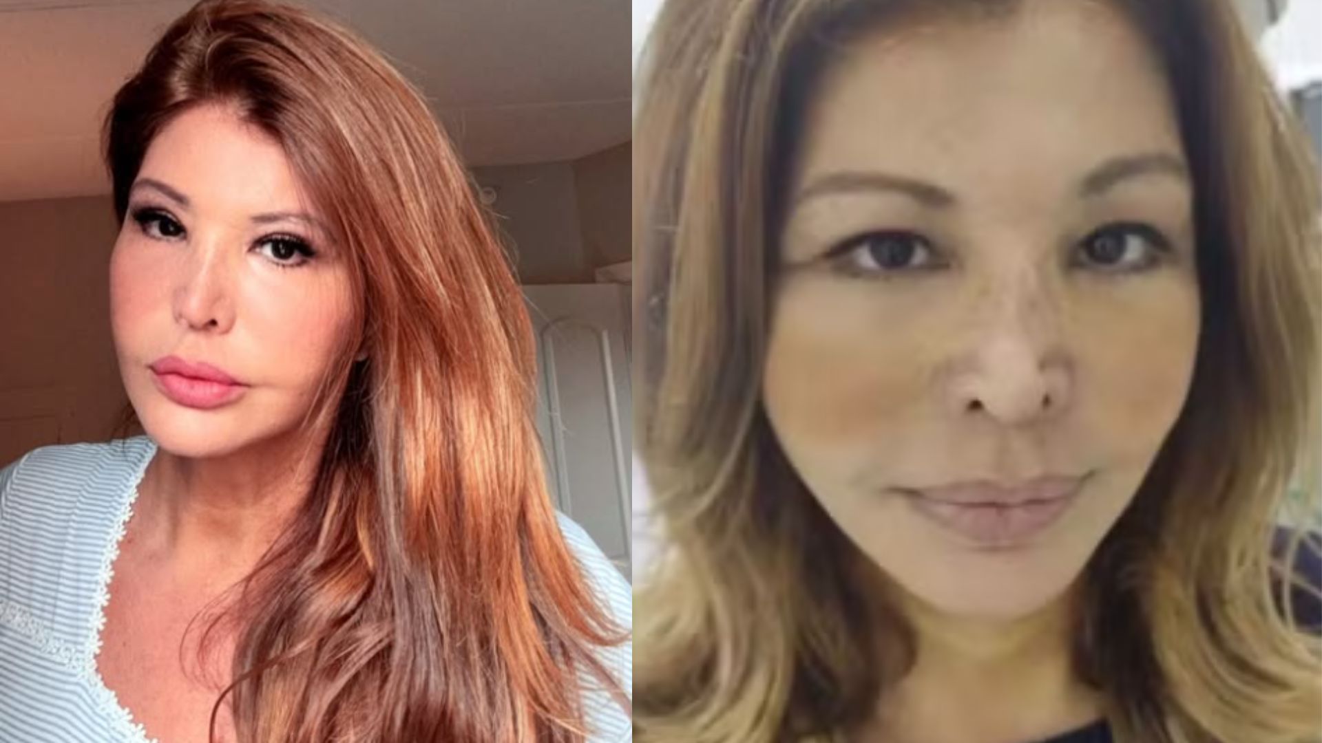 Roberta Close, antes e depois - Fotos: Reprodução/Instagram