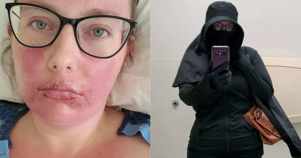 Emily não pode ser exposta a raios UV