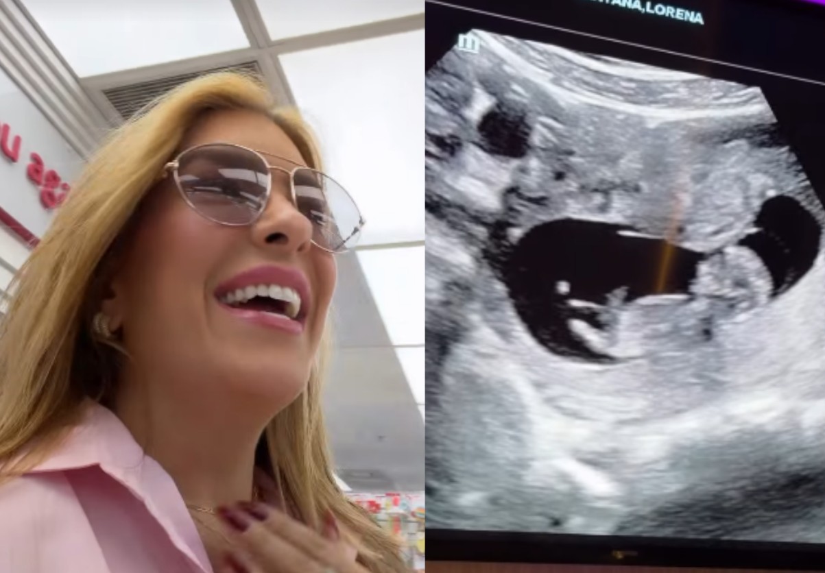 Lore Improta mostra ultrassom da segunda gravidez e se emociona: ‘Tá dançando’