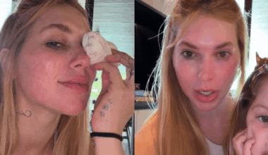 Virginia Fonseca mostra machucado nos olhos