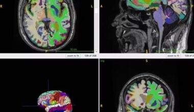 Mais músculos e menos gordura abdominal podem retardar o envelhecimento cerebral