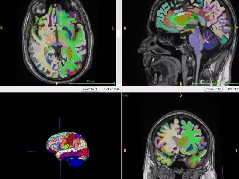 Mais músculos e menos gordura abdominal podem retardar o envelhecimento cerebral