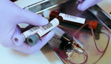 Imunoterapia pode ser caminho promissor para a cura do HIV, aponta estudo