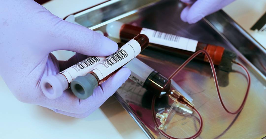 Imunoterapia pode ser caminho promissor para a cura do HIV, aponta estudo