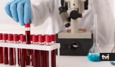 Há um novo exame que identifica mais de 50 cancros antes de surgirem sintomas - Dois às 10