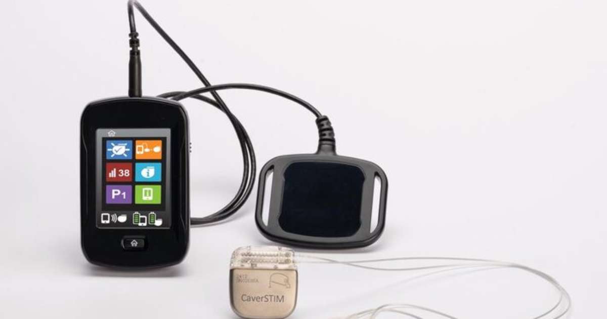 Dispositivo eletrônico preserva a ereção em 9 entre 10 pacientes submetidos à retirada da próstata