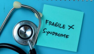 Síndrome do X Frágil: conheça as causas e os sintomas