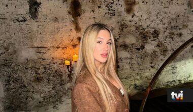 Bárbara Parada submete-se a intervenção estética: Veja o antes e depois - Secret Story