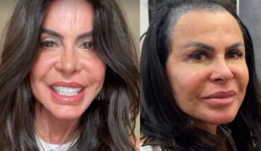 nome artístico, alopécia, 18 casamentos; veja 7 curiosidades sobre a artista