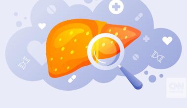 Dieta rica em gordura aumenta o risco de cancro do fígado