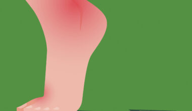 O que é gota e por que está se tornando mais comum - 30/12/2025 - Equilíbrio