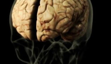 Pessoas com deficiência intelectual têm maior risco de transtornos mentais, diz estudo