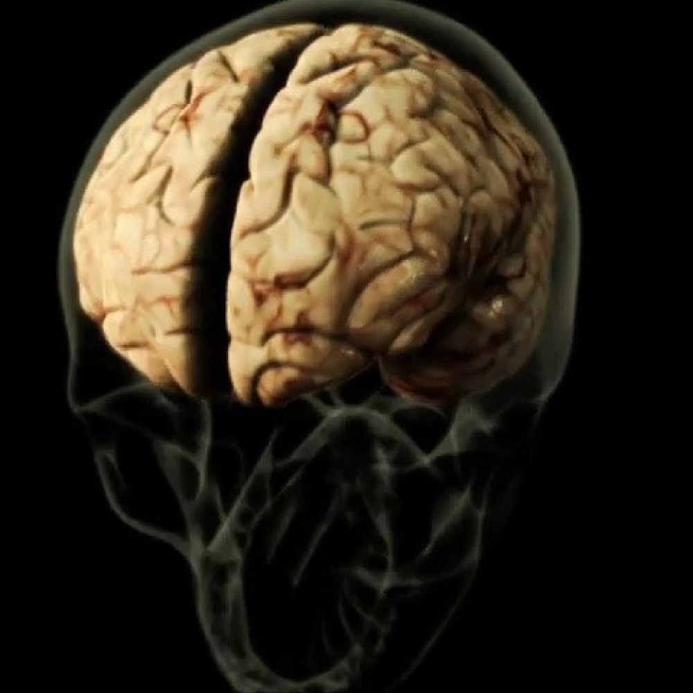 Pessoas com deficiência intelectual têm maior risco de transtornos mentais, diz estudo