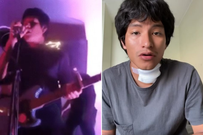 O vocalista da banda de rock Mi Major Amigo Scott desmaiou após levar um choque do microfone durante uma apresentação em Lima, Peru -  (crédito: Reprodução/ redes sociais)
