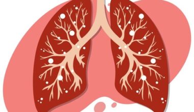 Biópsia líquida avança na detecção de mutações no câncer de pulmão