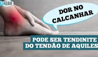 Dor no calcanhar pode indicar tendinite de Aquiles