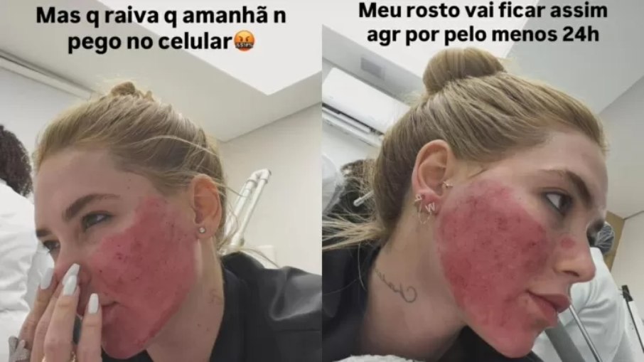 Virginia surpreende ao mostrar rosto após procedimentos estéticos intensos