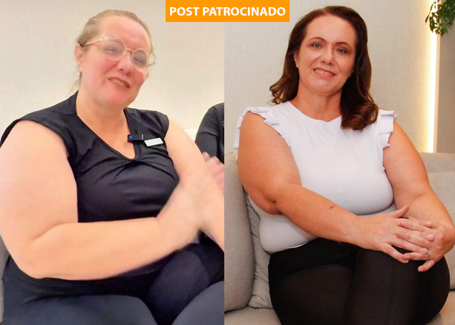 Mulher perde peso e recupera autoestima aos 47 anos: "Me sinto outra pessoa"