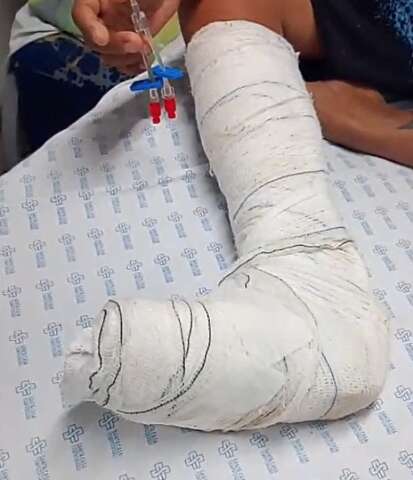 Paciente com esquizofrenia aguarda cirurgia há 5 dias na Santa Casa