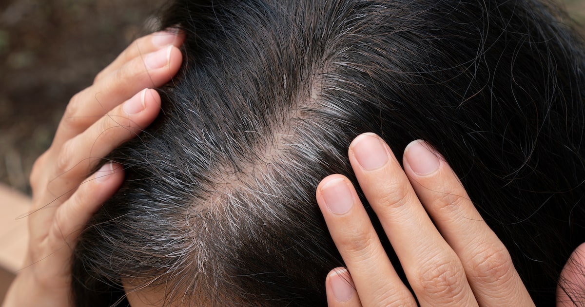 Entenda por que o cabelo fica grisalho — e o que você pode fazer sobre isso