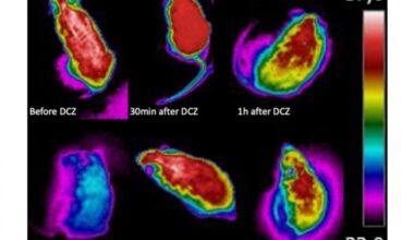 Pesquisadores descobrem um mesmo conjunto de neurônios responsável pela febre e pelo torpor