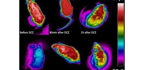 Pesquisadores descobrem um mesmo conjunto de neurônios responsável pela febre e pelo torpor