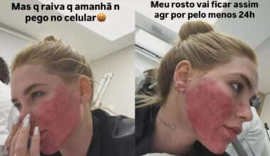 Virginia surpreende ao mostrar rosto após procedimentos estéticos