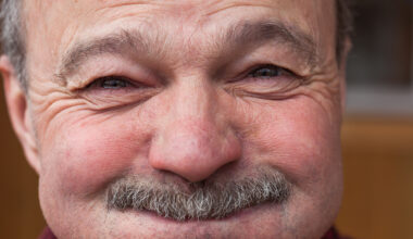 Rir não é o melhor remédio? Alex morreu após meia hora de gargalhadas