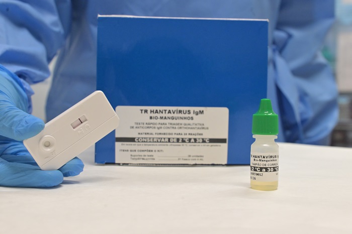 Kit hantavírus. 