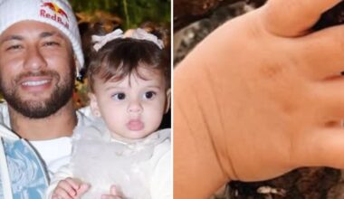 Dedo da filha de Neymar: imagem atualizada surpreende e revela situação real; o que mudou?