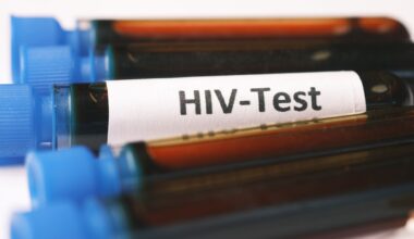 HIV e condições proctológicas aumento de risco em pacientes soropositivos