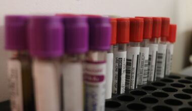 Hospital Dr. Ib Gatto Falcão reforça alerta à população sobre os casos de sífilis silenciosa – Saúde Alagoas