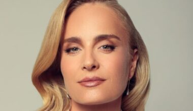 Angélica já quis retirar pinta icônica na perna e revela que marca tem médico particular