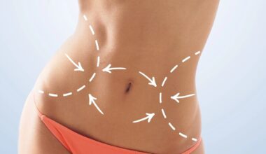 Avatar personalizável. Há mulheres a gastar uma fortuna para retirar costelas