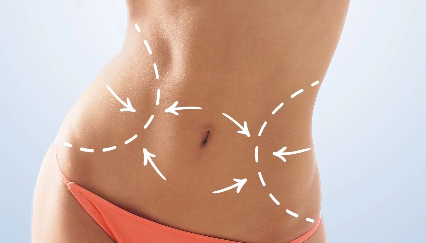 Avatar personalizável. Há mulheres a gastar uma fortuna para retirar costelas