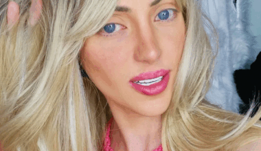 Laudo aponta causa da morte de influenciadora conhecida como “Barbie humana”