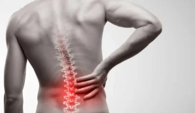 Beneficios-a-longo-prazo-da-cirurgia-de-artrose-na-coluna