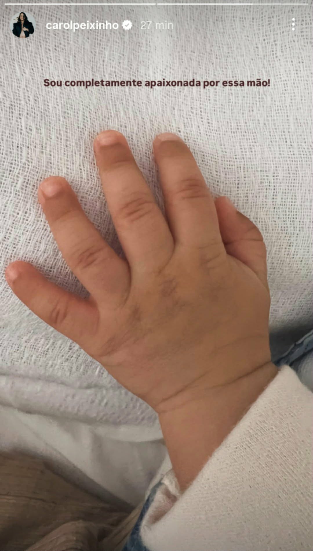 Carol Peixinho mostra a mão do filho