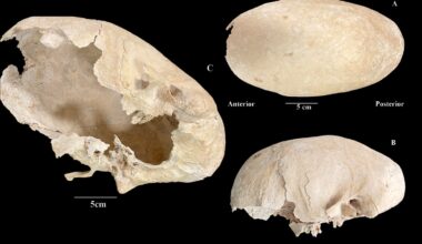 “Nunca tinha visto nada assim”. Cavaleiro da Ordem de Calatrava tinha crânio alongado