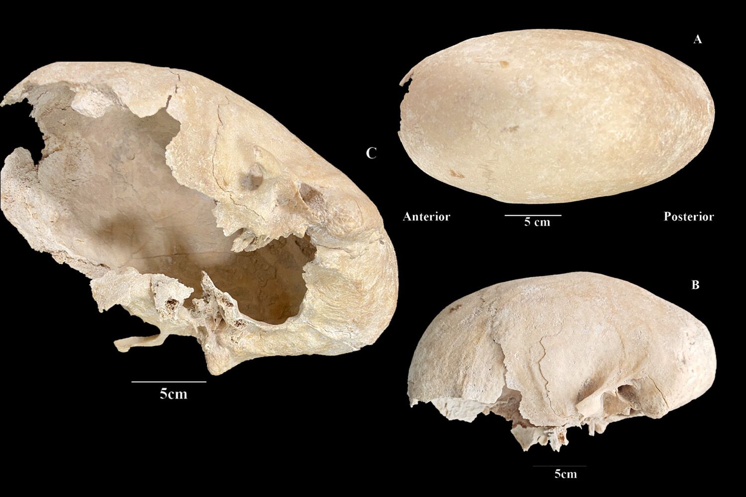 “Nunca tinha visto nada assim”. Cavaleiro da Ordem de Calatrava tinha crânio alongado