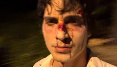 Fiuk aparece com rosto ensanguentado e assusta fãs: 'Precisa de tratamento'