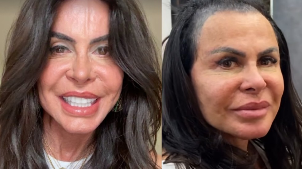 Gretchen abriu o coração sobre alopecia e cuidados com os cabelo — Foto: Reprodução Instagram