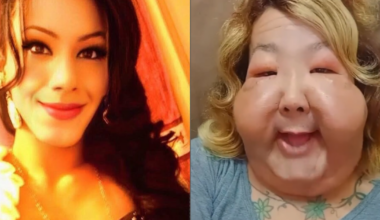 Médico mostra os resultados de cirurgia de reconstrução de Juju do Pix