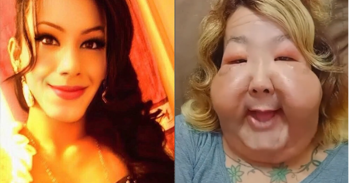 Médico mostra os resultados de cirurgia de reconstrução de Juju do Pix